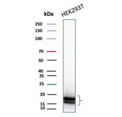 Western blot analysis of CDKN2A in human HEK293T cell lysate using a CDKN2A/Cyclin-dependent kinase inhibitor 2A antibody (clone rCDKN2A/13303). An immunoreactive signal is detected in the ~16 kDa region, appearing as a closely spaced doublet consistent with the predicted molecular weight of Cyclin-dependent kinase inhibitor 2A. The presence of a doublet may reflect heterogeneity in electrophoretic migration commonly observed for small regulatory proteins. Proteins were resolved by SDS-PAGE under reducing conditions and transferred to a membrane prior to antibody incubation. Signal detection was performed using an HRP-conjugated secondary antibody and chemiluminescent substrate.