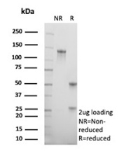 SDS-PAGE analysis of purified, BSA-free CDKN2A/Cyclin-dependent kinase inhibitor 2A antibody (clone rCDKN2A/13303) as confirmation of integrity and purity.
