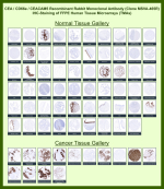 Immunohistochemical analysis of FFPE human tissue microarrays stained with CEACAM5 / Carcinoembryonic antigen antibody (clone MSVA-465R). In normal tissues, staining is largely restricted to epithelial cell populations with membranous and luminal surface localization, consistent with known CEACAM5 expression patterns in gastrointestinal and glandular epithelia. In cancer tissues, strong membranous and cytoplasmic staining is observed in tumor epithelial cells in multiple carcinoma types, while surrounding stromal and non-epithelial cells remain negative. The observed staining distribution is consistent with reported CEACAM5 expression profiles in publicly available expression atlases such as the Human Protein Atlas.<BR>Manual protocol: freshly cut tissue sections (less than 10 days between cutting and staining) were used. Heat-induced antigen retrieval was performed for 5 minutes in an autoclave at 121C using pH 7.8 target retrieval solution. The antibody was applied at a dilution of 1:150 and incubated at 37C for 60 minutes. Detection was performed using an EnVision-based visualization system according to the manufacturerâs instructions.