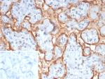Immunohistochemistry analysis of formalin-fixed, paraffin-embedded human placenta tissue using CGB3 antibody (clone HCGb/7512R). Prominent membranous and pericellular staining is observed in trophoblastic cells, with signal outlining villous structures and minimal background staining in surrounding stromal areas. Nuclei are counterstained in blue. Inset shows PBS substituted for the primary antibody as a secondary-only negative control. Heat-induced antigen retrieval was performed by heating tissue sections in 10 mM Tris with 1 mM EDTA, pH 9.0, for 45 minutes at 95oC, followed by cooling at room temperature for 20 minutes.