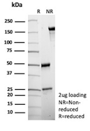 SDS-PAGE Analysis of Purified CHAT/Choline O-acetyltransferase antibody (clone r38B12). Confirmation of Purity and Integrity of Antibody.