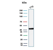 Western blot analysis of human Y79 cell lysate using CKB/Creatine kinase B-type antibody (clone CKBB/8295R). Predicted molecular weight ~43 kDa.