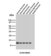 Western blot analysis of human pancreas, mouse pancreas, rat pancreas, hamster pancreas, guinea pig pancreas, and rabbit pancreas tissue lysates using CLPS/Colipase antibody (clone CLPS/12806R). A single immunoreactive band is observed at the predicted molecular weight (~12 kDa) for Colipase across all pancreatic samples except rabbit, with comparable signal intensity between species and minimal non-specific background.