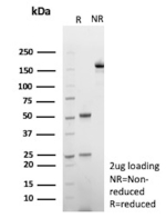 SDS-PAGE Analysis of purified CPS1/Carbamoyl-phosphate synthase 1 antibody (clone CPS1/9870). Confirmation of Purity and Integrity of Antibody.