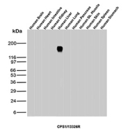 Western blot analysis of CPS1 expression. Human brain, heart, intestine, kidney, liver, lung, pancreas, skeletal muscle, skin, spleen, and stomach tissue lysates were analyzed using recombinant Hepatocyte specific antigen/CPS1 antibody (CPS1/13326R). A prominent immunoreactive band is observed in human liver lysate at the predicted molecular weight of approximately 165 kDa, consistent with the known size of Carbamoyl-phosphate synthase 1. No corresponding bands are detected in non-hepatic tissues, reflecting the liver-enriched expression pattern of CPS1.