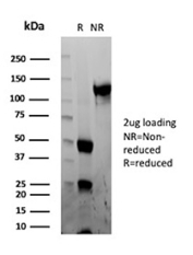 SDS-PAGE Analysis of purified Hepatocyte specific antigen/CPS1 antibody (clone CPS1/13326R). Confirmation of Purity and Integrity of Antibody.