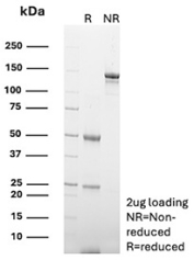 SDS-PAGE Analysis of recombinant Alpha-crystallin B chain antibody (clone rG2JF). Confirmation of Purity and Integrity of Antibody.