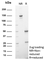 SDS-PAGE Analysis of purified recombinant CTSG/Cathepsin G antibody (clone r19C3). Confirmation of Purity and Integrity of Antibody.