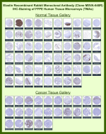 Immunohistochemistry tissue microarray analysis of Elastin expression. Recombinant ELN/Elastin antibody (clone MSVA-648R) was evaluated by immunohistochemistry on formalin-fixed, paraffin-embedded human tissue microarrays representing a broad panel of normal and cancer tissues. Staining highlights extracellular matrix-associated and elastic fiber localization in tissues known to contain elastic structures, including vascular, pulmonary, and connective tissue compartments, with minimal staining in tissues lacking elastic fibers. Cancer tissues show variable stromal and vascular-associated immunoreactivity depending on tumor type. Overall staining distribution and relative expression patterns are consistent with publicly available expression data reported by the Human Protein Atlas, supporting the biological relevance of the observed immunostaining.