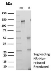 SDS-PAGE Analysis of purified TIGIT antibody (clone TIGIT/3033). Confirmation of Purity and Integrity of Antibody.