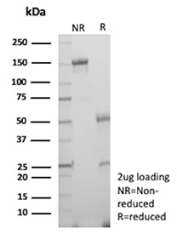 SDS-PAGE Analysis of purified Immune Checkpoint TIGIT antibody (clone TIGIT/3034). Confirmation of Purity and Integrity of Antibody.