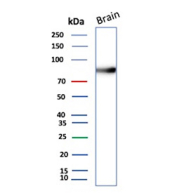 Western blot analysis of human brain tissue lysate using recombinant ENG/Endoglin antibody (clone r4G11). This glycosylated protein is observed at molecular weight: 70-90 kDa (monomer) and 140-180 kDa (dimer).