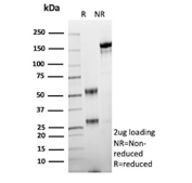 SDS-PAGE Analysis of Purified HER2/ERBB2 antibody (clone r5A2). Confirmation of Purity and Integrity of Antibody.