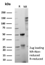SDS-PAGE Analysis of purified recombinant ERG/ERG transcription factor antibody (clone ERG/9604R). Confirmation of Purity and Integrity of Antibody.