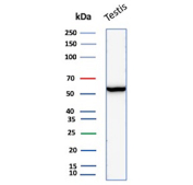 Western blot analysis of human testis tissue lysate using Estrogen Receptor Beta 2 Mouse Monoclonal Antibody (ESR2/6661).