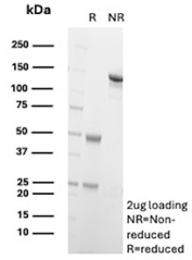 SDS-PAGE Analysis of Purified Transcription Factor ETS1 antibody (clone r1G11). Confirmation of Purity and Integrity of Antibody.