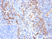Immunohistochemistry analysis of ALCAM / CD166 in human tonsil. Formalin-fixed, paraffin-embedded human tonsil tissue stained with ALCAM/Activated leukocyte cell adhesion molecule antibody (rALCAM/9811). Brown chromogenic signal indicates ALCAM-positive cells, with membranous and cytoplasmic brown staining observed in lymphoid cells. Inset shows PBS substituted for the primary antibody as a negative control. Heat-induced epitope retrieval was performed using 10mM Tris with 1mM EDTA, pH 9.0, at 95oC for 45 minutes, followed by cooling at room temperature.