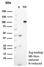 SDS-PAGE Analysis of purified recombinant CD166/ALCAM antibody (clone rMOG/07). Confirmation of Purity and Integrity of Antibody.