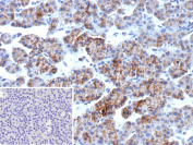 Formalin-fixed, paraffin-embedded human parathyroid gland stained with recombinant CD166/ALCAM antibody (clone rMOG/07). Inset: PBS instead of primary antibody; secondary only negative control. Staining of formalin-fixed tissues requires heating tissue sections in 10mM Tris with 1mM EDTA, pH 9.0, for 45 min at 95Â°C followed by cooling at RT for 20 minutes.