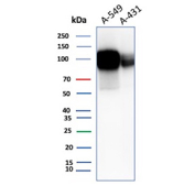 Western blot analysis of human A549 and A431 cell lysates using recombinant CD166/ALCAM antibody (clone rMOG/07). Predicted molecular weight ~65 kDa (unmodified), 100-105 kDa (glycosylated).