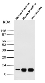 Western blot analysis of Human Intestine, Mouse Intestine and Rat Intestinal FABP/Intestinal fatty acid-binding protein antibody (FABP2/6345).
