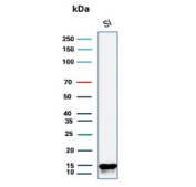 Western blot analysis of human small intestine tissue lysate using Intestinal fatty acid-binding protein antibody (clone FABP2/6936). Predicted molecular weight ~15 kDa.