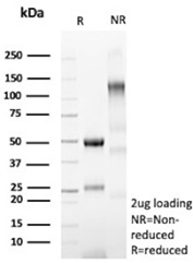 SDS-PAGE Analysis of purified FCGR1A/High affinity immunoglobulin gamma Fc receptor I antibody (clone FCGR1A/7499).  Confirmation of Purity and Integrity of Antibody.