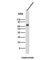 Western blot testing of human brain tissue lysate with FCGR1A/High affinity immunoglobulin gamma Fc receptor I antibody (clone FCGR1A/7499). Predicted molecular weight: 39-75 kDa depending on glycosylation level.
