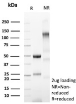 SDS-PAGE Analysis of Purified CD64 Mouse Monoclonal Antibody (FCGR1A/7499).  Confirmation of Purity and Integrity of Antibody.