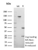 SDS-PAGE Analysis of purified recombinant FLG/Filaggrin antibody (clone r15C10). Confirmation of Purity and Integrity of Antibody.
