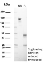 SDS-PAGE Analysis of RHOBTB2/Deleted in breast cancer gene 2 antibody (clone DBC2/12581). Confirmation of Purity and Integrity of Antibody.