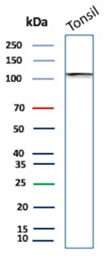 Western blot analysis of human tonsil cell lysate using SATB2 Mouse Monoclonal Antibody (SATB2/7489).