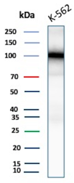 Western blot analysis of K-562 cell lysate using SATB2 Recombinant Rabbit Monoclonal Antibody (SATB2/9432R).