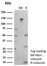 SDS-PAGE Analysis of purified recombinant FOLH1/Prostate-specific membrane antigen antibody (clone FOLH1/9735R).  Confirmation of Purity and Integrity of Antibody.