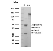 SDS-PAGE analysis of recombinant FOLR1 antibody. Purified recombinant FOLR1/Folate receptor 1 antibody (clone rFOLR1/13324) was analyzed by SDS-PAGE under non-reducing (NR) and reducing (R) conditions. Under non-reducing conditions, the antibody migrates predominantly as a high-molecular-weight band consistent with intact immunoglobulin, while reducing conditions resolve bands corresponding to antibody heavy and light chains. The gel demonstrates high sample purity and intact antibody structure.
