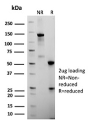 SDS-PAGE Analysis of Purified FOLR1/Folate Receptor Alpha antibody (clone FOLR1/12910R). Confirmation of Purity and Integrity of Antibody.