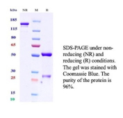 SDS-PAGE Analysis of purified recombinant FOLR1/FR alpha antibody (clone FOLR1/13424R). Confirmation of Purity and Integrity of Antibody.