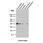 Western blot analysis of Folate receptor alpha expression in brain tissue lysates. Brain tissue lysates from human, mouse, rat, hamster, and guinea pig were analyzed by western blot using recombinant FOLR1/FR alpha antibody (clone FOLR1/13424R). A single immunoreactive band is detected above the predicted molecular weight. Although the predicted molecular weight of Folate receptor alpha is approximately 30 kDa based on sequence analysis, the protein is extensively glycosylated, resulting in a higher apparent molecular weight on SDS-PAGE.