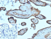 Immunohistochemistry of Folate receptor alpha in human placental tissue. Formalin-fixed, paraffin-embedded human placenta stained with recombinant FOLR1/FR alpha antibody (clone FOLR1/13424R) shows membranous staining in trophoblastic cells lining chorionic villi, with minimal signal in surrounding stromal regions. Inset shows negative control with PBS substituted for the primary antibody. Antigen retrieval was performed by heating tissue sections in 10 mM Tris with 1 mM EDTA, pH 9.0, at 95oC for 45 minutes, followed by cooling at room temperature for 20 minutes.