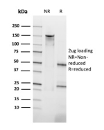 SDS-PAGE Analysis of purified PADI4/Protein-arginine deiminase type-4 antibody (clone IPO-M6). Confirmation of Purity and Integrity of Antibody.