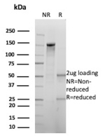 SDS-PAGE analysis of purified GAD1/Glutamate decarboxylase 1 antibody (clone BICCN-GAD67-1A6). Confirmation of Purity and Integrity of Antibody.