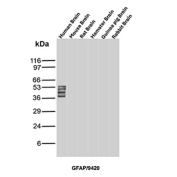 Western blot analysis of human, mouse, rat, hamster, guinea pig, and rabbit brain tissue lysates probed with GFAP/Glial fibrillary acidic protein antibody (clone GFAP/9420). A dominant band is detected near the predicted molecular weight of approximately 50 kDa, corresponding to full-length glial fibrillary acidic protein. Additional closely spaced bands are observed in the same molecular weight range and are consistent with known GFAP isoforms and post-translationally modified species, which are well documented in the literature. The conserved multi-band pattern across species supports specific detection of GFAP-related protein forms rather than non-specific binding.
