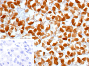 Formalin-fixed, paraffin-embedded human stomach tissue stained with recombinant GLUL/Glutamine synthetase antibody (clone GLUL/12902R). Strong cytoplasmic brown chromogenic staining is observed in gastric epithelial cells, consistent with Glutamine synthetase expression, while nuclei are counterstained blue. Inset shows a PBS-only negative control processed without primary antibody, demonstrating minimal non-specific background staining.