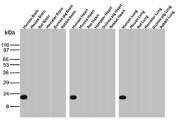Western blot analysis of human, mouse, rat, hamster, guinea pig, and rabbit brain, heart, and lung tissue lysates probed with recombinant GSTP1/Glutathione S-transferase pi 1 antibody (clone GSTP1/12956R). A single prominent band is detected near the predicted molecular weight of approximately 23 kDa, consistent with Glutathione S-transferase pi 1. The conserved band pattern across multiple tissues and species supports specific detection of GSTP1, a cytosolic phase II detoxification enzyme broadly expressed in epithelial and parenchymal cells.