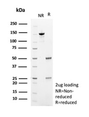 SDS-PAGE Analysis of purified HLA-E/HLA class I histocompatibility antigen E antibody (clone HLAE/9467). Confirmation of Purity and Integrity of Antibody.