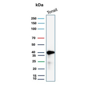 Western blot analysis of human tonsil tissue lysate probed with MHC-E/MHC class I antigen E antibody (clone HLAE/13125). A distinct band is detected near the predicted molecular weight of approximately 40-45 kDa, consistent with MHC class I antigen E heavy chain expression in lymphoid tissue. The observed band pattern supports specific detection of MHC-E in immune cell-enriched tissue lysates.