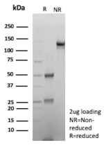 SDS-PAGE Analysis of purified recombinant HSPB1/Heat shock protein beta 1 antibody (clone r2B4). Confirmation of Purity and Integrity of Antibody.