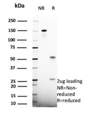 SDS-PAGE Analysis of purified HSD17B13/Hydroxysteroid 17 beta dehydrogenase 13 antibody (clone HSD17B13/13105). Confirmation of Purity and Integrity of Antibody.