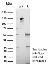 SDS-PAGE Analysis of purified Hepatic lipid droplet protein antibody (clone HSD17B13/13107). Confirmation of Purity and Integrity of Antibody.
