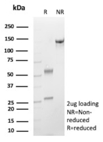 SDS-PAGE of Analysis purified recombinant IGHE/Immunoglobulin heavy constant epsilon antibody (clone rIGHE/13128). Confirmation of Purity and Integrity of Antibody.